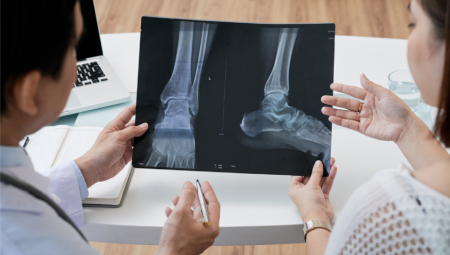 Gói khám tầm soát xương khớp