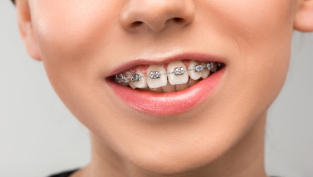 Thẩm mỹ răng, thẩm mỹ nha chu, thẩm mỹ hàm mặt, chỉnh nha,…