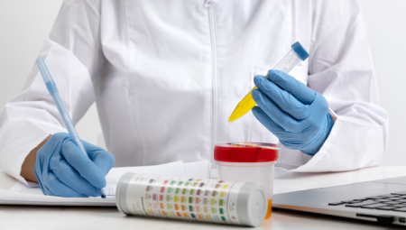 Xét nghiệm nước tiểu