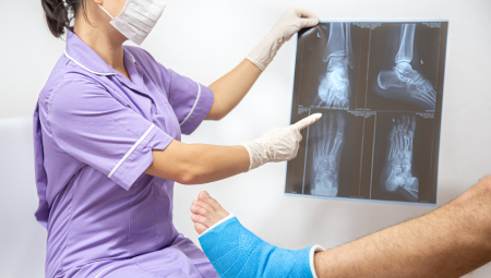 Nẹp cố định và bó bột các trường hợp gãy xương