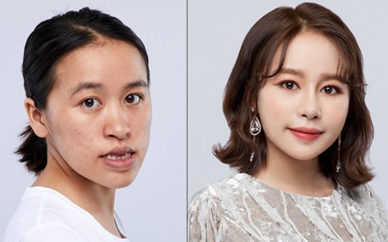 Phẫu thuật thẩm mỹ thay đổi hoàn toàn gương mặt