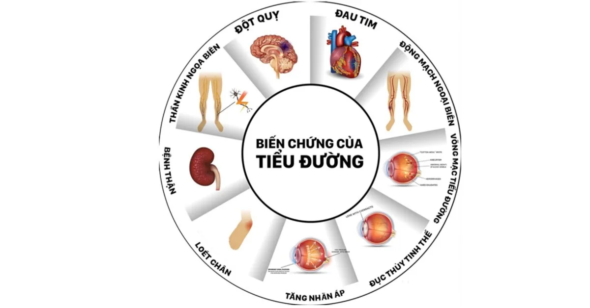 Những kiến thức cơ bản dành cho người bệnh đái tháo đường (ĐTĐ) - Hình 2 - Bệnh viện SANTE Bình Thạnh, TP.HCM