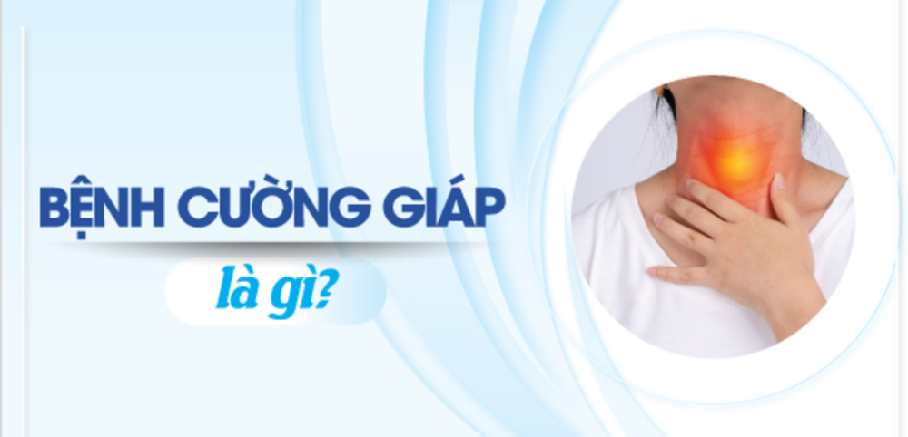 Cường giáp nguyên nhân dấu hiệu và cách điều trị 2