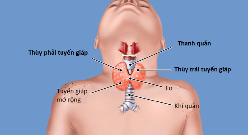 Cường giáp nguyên nhân dấu hiệu và cách điều trị 