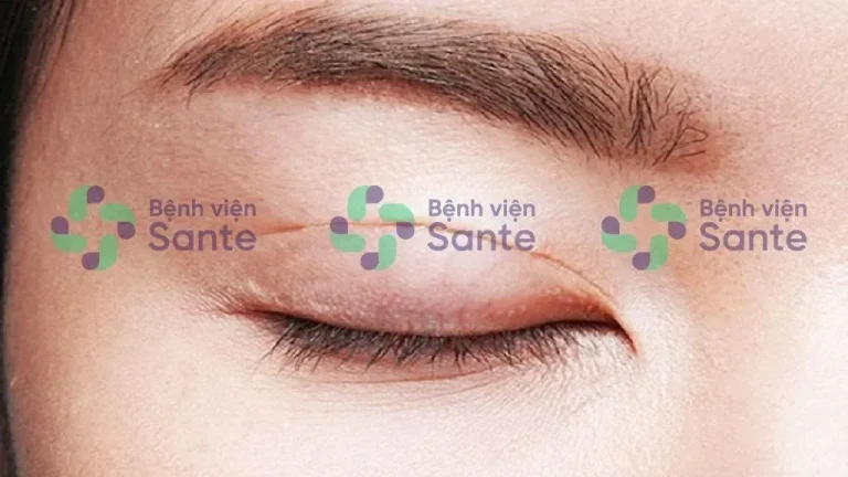 Bệnh viện phẫu thuật chỉnh hình cắt mí mắt tại TPHCM ở đâu tốt nhất