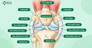Thay Khớp Gối Là Gì? Chỉ Định, Quy Trình & Phục Hồi Sau Mổ