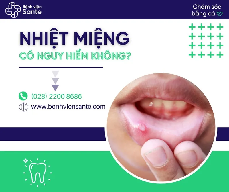 Bệnh viện Sante - Nhiệt miệng có nguy hiểm không?