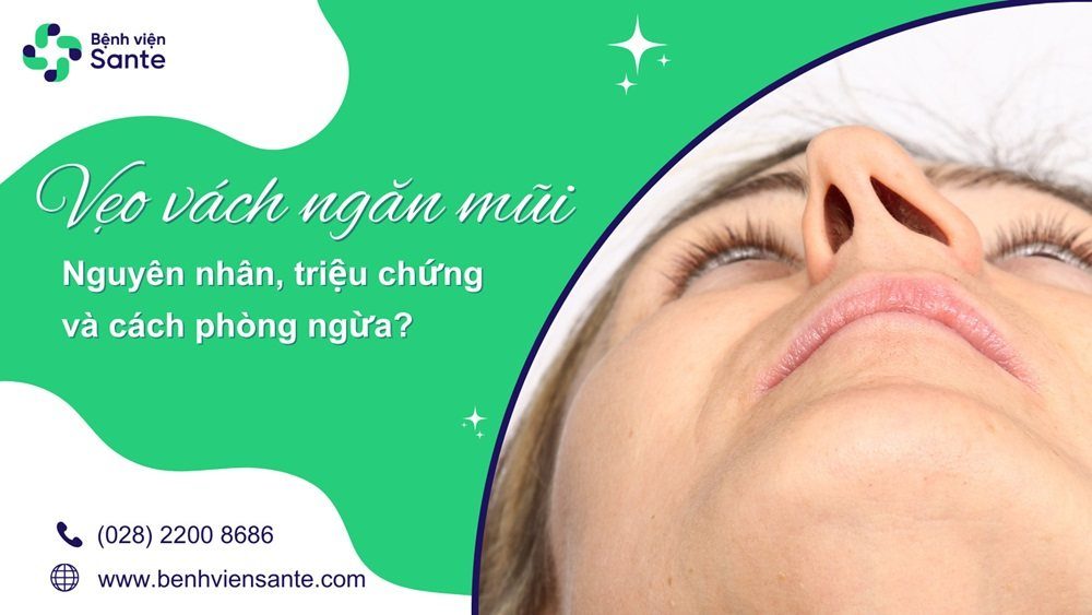 Vẹo vách ngăn mũi - Nguyên nhân, triệu chứng và cách phòng ngừa