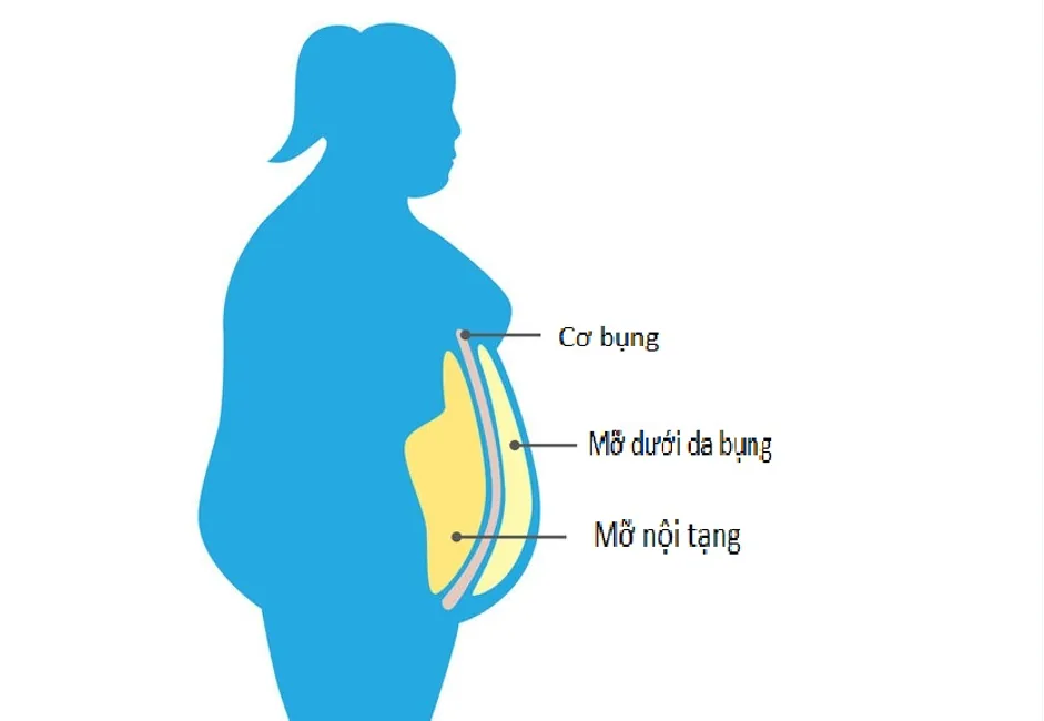 NGUYÊN NHÂN GÂY MỠ NỘI TẠNG - Hình 3 - Bệnh viện SANTE Bình Thạnh, TP.HCM NGUYÊN NHÂN GÂY MỠ NỘI TẠNG - Hình 3 - Bệnh viện SANTE Bình Thạnh, TP.HCM