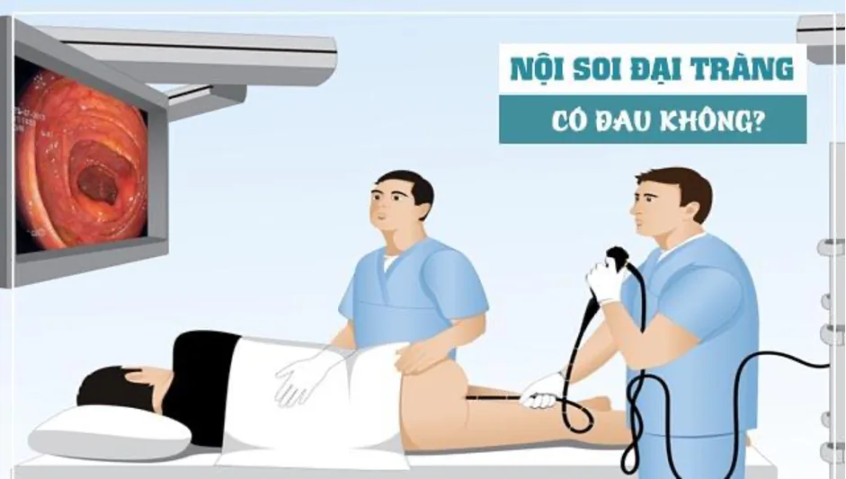 Các phương pháp tầm soát ung thư đại trực tràng - Hình 3 - Bệnh viện SANTE Bình Thạnh, TP.HCM Các phương pháp tầm soát ung thư đại trực tràng - Hình 3 - Bệnh viện SANTE Bình Thạnh, TP.HCM